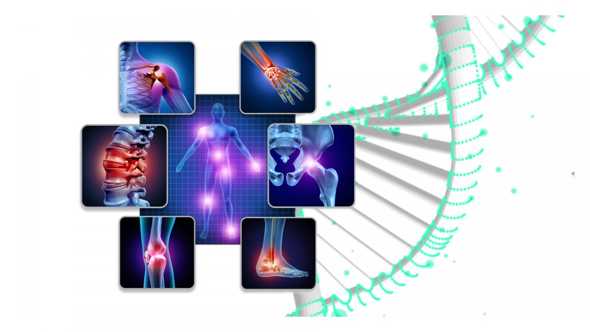 Fibromyalji